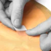 Igneous - Repair Spool - Field Repair Kit